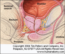 The shape of the prostate
